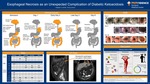 Esophageal Necrosis as an Unexpected Complication of Diabetic Ketoacidosis by Hayden Smith and Tricia James