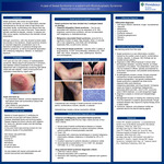 A case of sweet Syndrome in a patient with Myelodysplastic Syndrome by Malia’ka Hall, DO and Elizabeth Hutshinson, MD