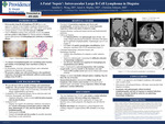 A Fatal ‘Sepsis’: Intravascular Large B-Cell Lymphoma in Disguise