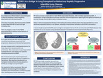 ECMO as a Bridge to Lung Transplant for Refractory Rapidly Progressive Interstitial Lung Disease