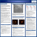 Postpartum Spontaneous Coronary Artery Dissection with Multivessel Arteriopathy by Devon Schaefer, DO and Cody Paiva, DO