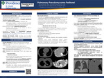 Pulmonary Pseudomyxoma Peritonei
