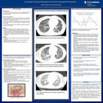 Case Study: A Severe Presentation of Chronic Eosinophilic Pneumonia. by Revati Kalluri and Mari Kai