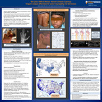 Not just a Biblical Disease: Hansen’s Disease (Leprosy) Oregon’s unique differential by Zach Taylor, Justin Jin, Andrea Roast, and Amy Dechet