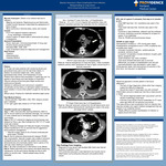 Mycotic Aneurysm and Rare Complication from Infection Masquerading as Lung Cancer