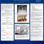 A Case of “Double Positive”  Goodpasture Syndrome