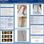 A clot to Worry About:  Venous Thromboembolism in Severe Ulcerative Colitis