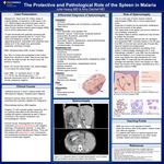 The Protective and Pathological Role of the Spleen in Malaria