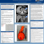 Don’t Poke the Bear:  Pheochromocytoma Unmasked by COVID-10