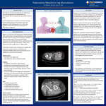Tuberculous Myositis in the Leg Musculature by Tho Nguyen, MD