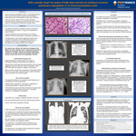 Still a wonder drug? Six weeks of high-dose steroid use leading to invasive  pulmonary aspergillosis in an immunocompetent male