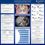 Unveiling the Mystery: Paraneoplastic Syndrome Masquerading as Skin Thickening and Arthritis