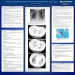 Pneumocystis jirovecii Pneumonia in an Immunocompetent Woman: A Case Report