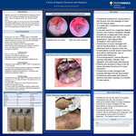 A Case of Kaposi's Sarcoma with Dyspnea