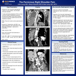 The Pernicious Right Shoulder Pain