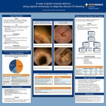 A Case Of Gluten-Induced Delirium: Using Capsule Endoscopy To Diagnose Occult GI Bleeding by Rachael Starcher and Lisa Sanders