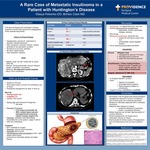 A Rare Case Of Metastatic Insulinoma  In A Patient With Huntington’s Disease