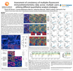 Assessment of consistency of multiplex fluorescent immunohistochemistry data across multiple users utilizing different quantitative analysis strategies